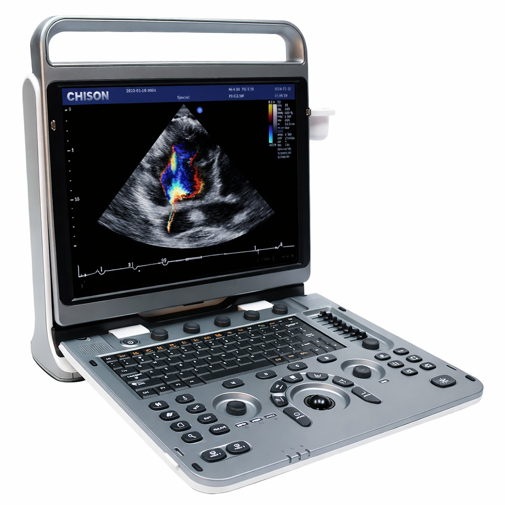 ultrasonido en cardiologia